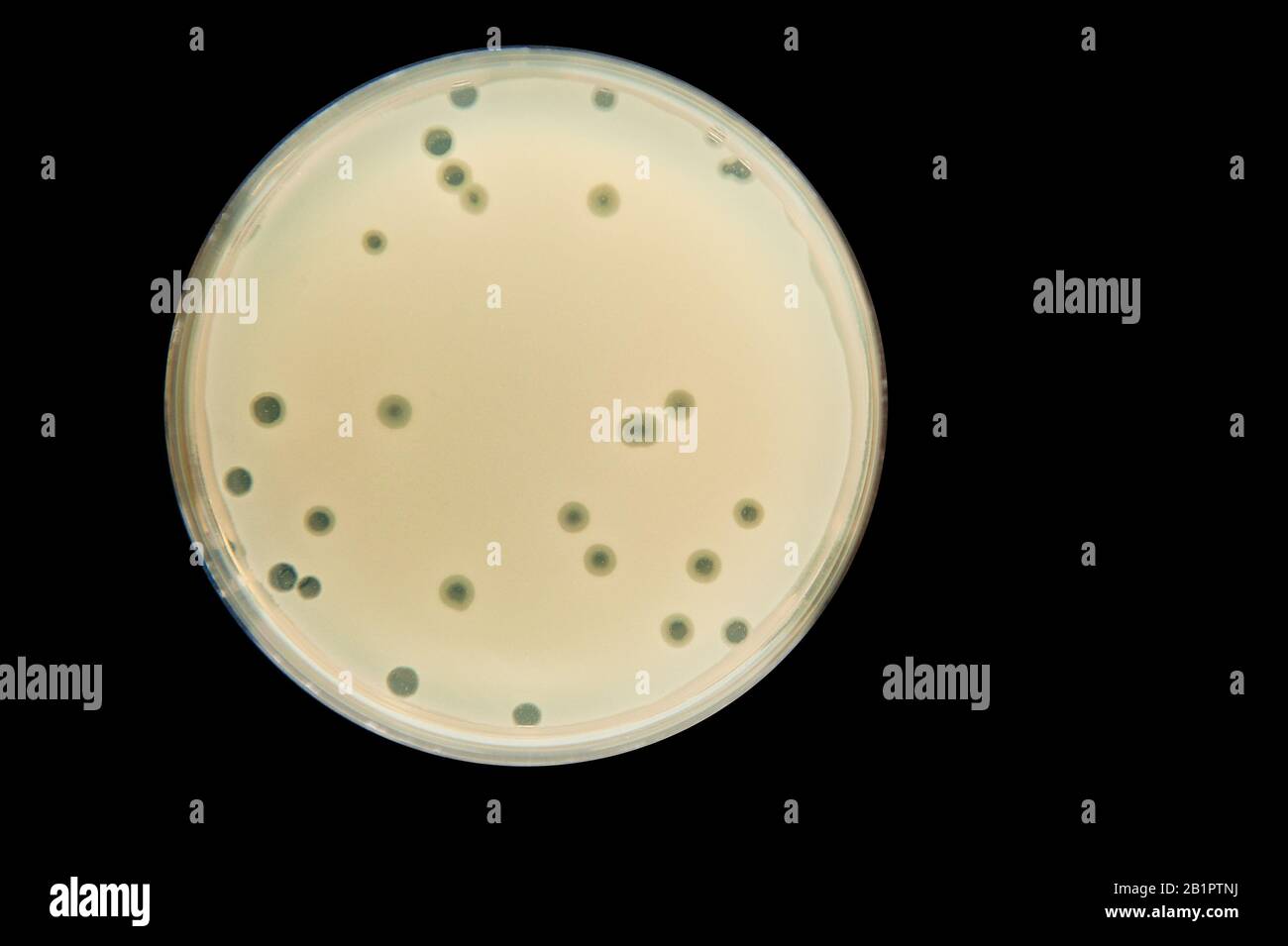 Petrischale mit Bakterienkultur mit Sphärenaktivität - Plaque Stockfoto