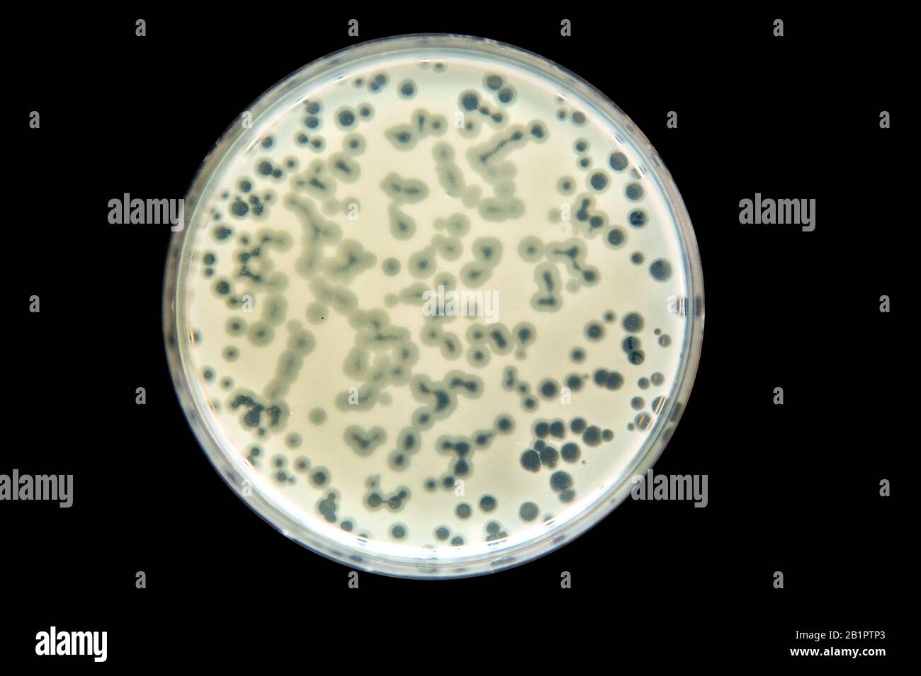 Petrischale mit Bakterienkultur mit Sphärenaktivität - Plaque Stockfoto