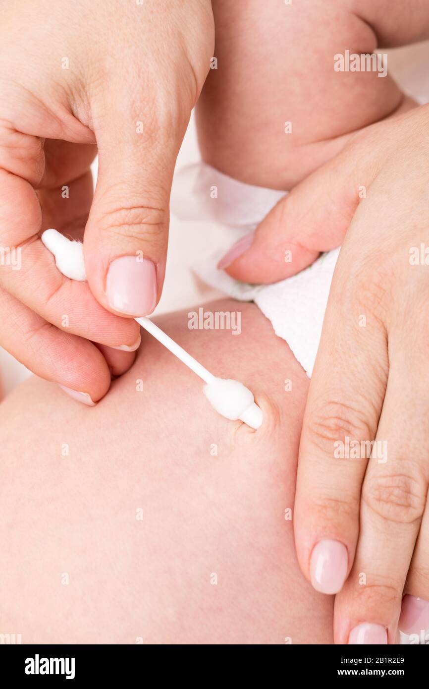 Mutter oder Kinderarzt verwendet einen Wattestäbchen, um den Bauchnabel (Bauchnabel) des neugeborenen Babys mit Wasser zu reinigen Stockfoto