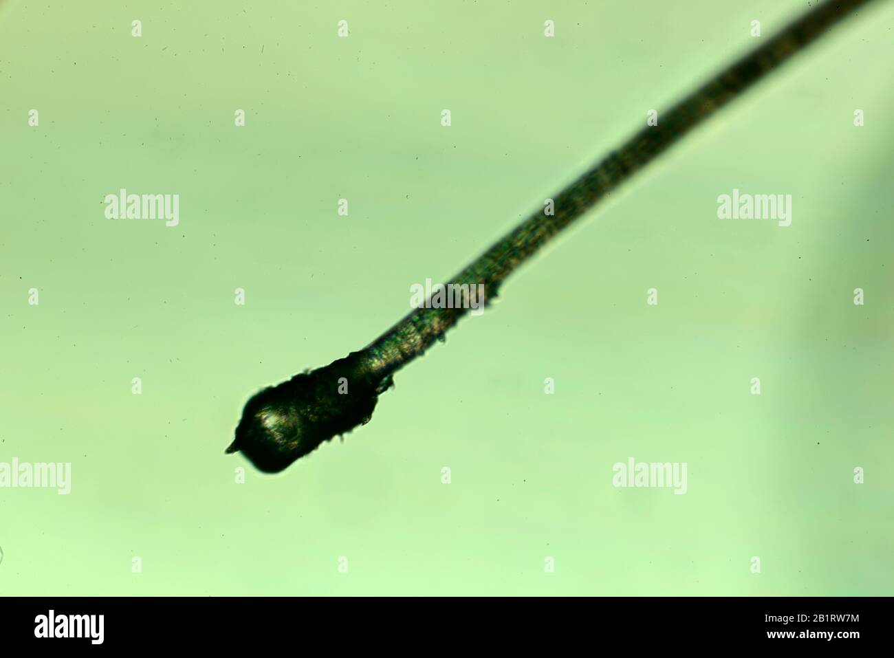 Menschliches Haar - mit Wurzel. Ein Proteinfilament, das aus Follikeln wächst, die in der Dermis gefunden wurden. Haare sind eines der prägenden Merkmale von Säugetieren. Stockfoto