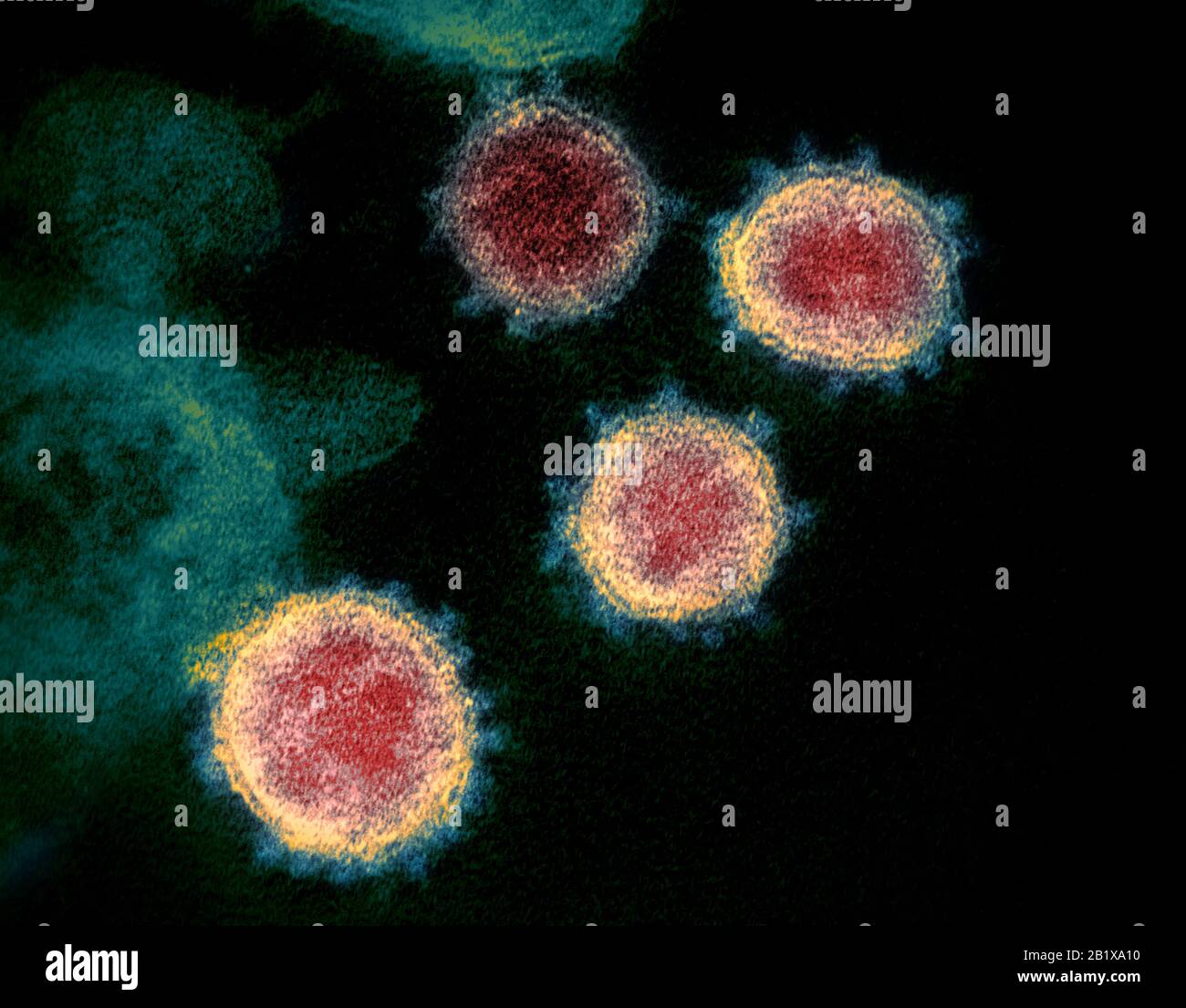 COVID-19 Roman Coronavirus SARS-COV-2 Dieses Elektronenmikroskop-Bild zeigt SARS-COV-2, auch bekannt als 2019-nCoV, das Virus, das COVID-19-isoliert von einem Patienten in den US-Virus-Partikeln verursacht, zeigt, dass es von der Oberfläche der im Labor kultivierten Zellen abstammt. Die Stacheln am äußeren Rand der Viruspartikel geben Coronaviren ihren Namen, kronenartig. Gutschrift: NIAID-RML Stockfoto