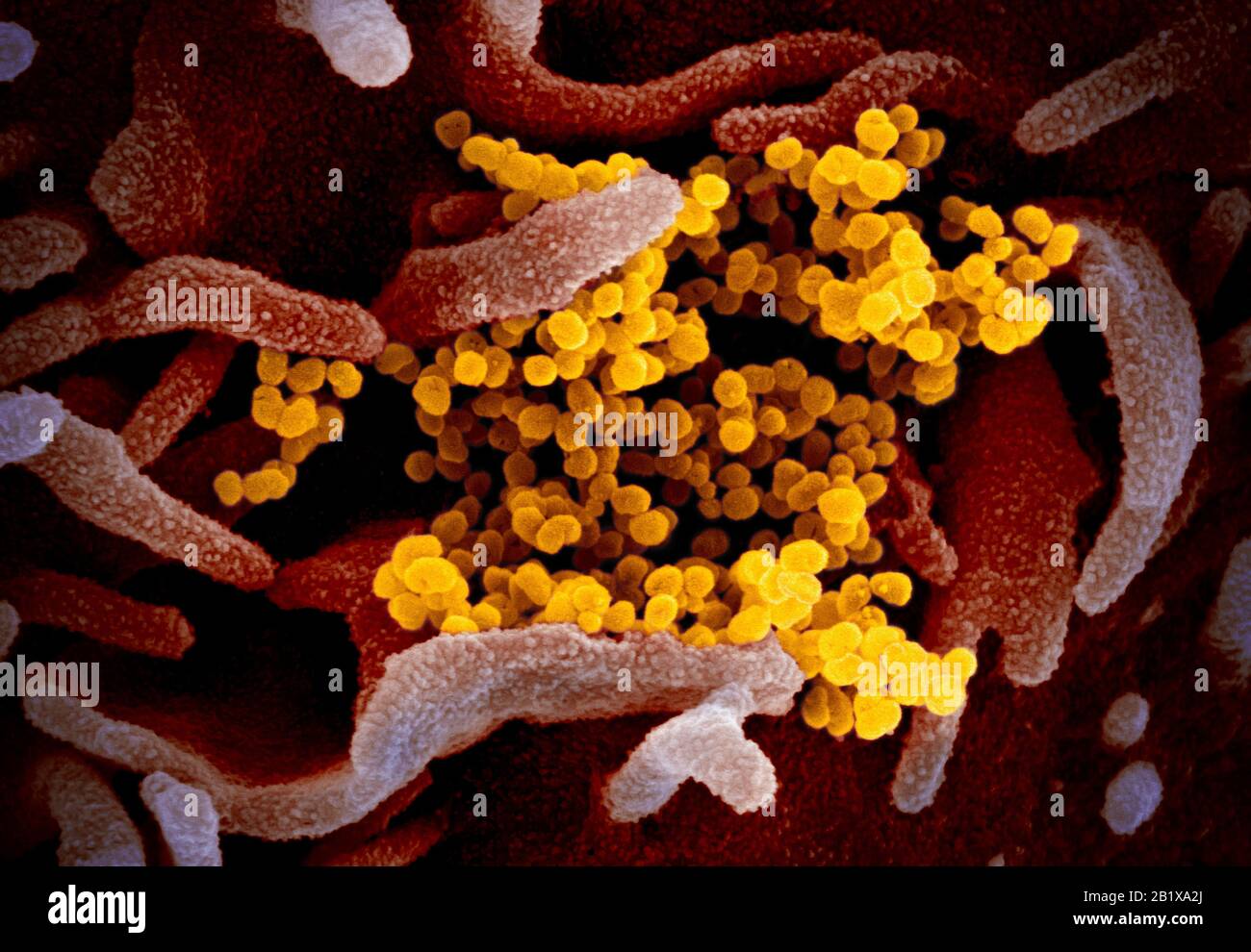 COVID-19. Novel Coronavirus SARS-COV-2 Dieses Rasterelektronenmikroskop-Bild zeigt SARS-COV-2 (gelb) - auch 2019-nCoV genannt - das Virus, das COVID-19-isoliert von einem Patienten in den USA verursacht und von der Oberfläche der im Labor kultivierten Zellen (pink) auftaucht. Gutschrift: NIAID-RML Stockfoto