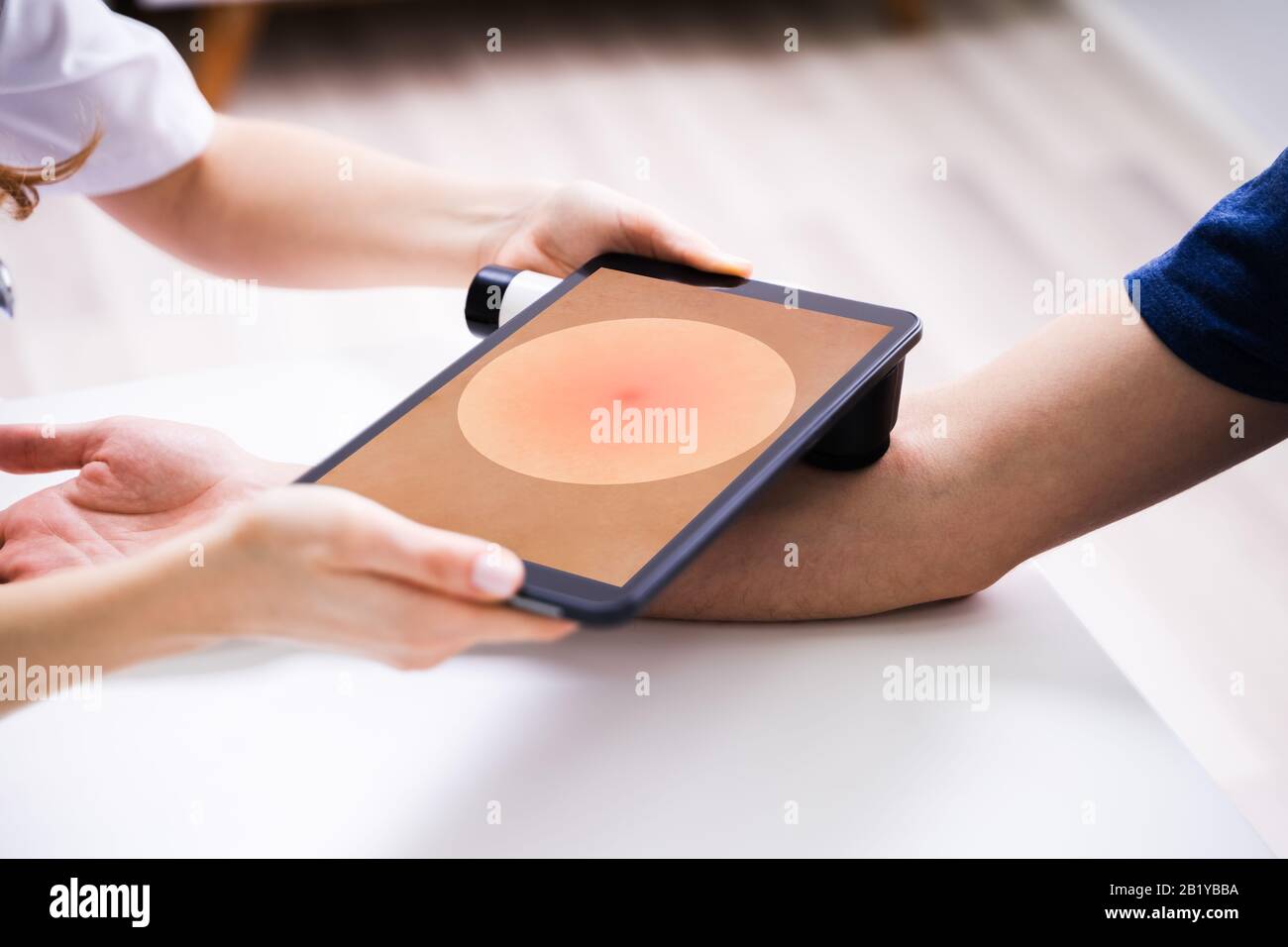 Weibliche Ärztin Untersucht Pigmentierte Haut Von Männlichen Patienten Stockfoto