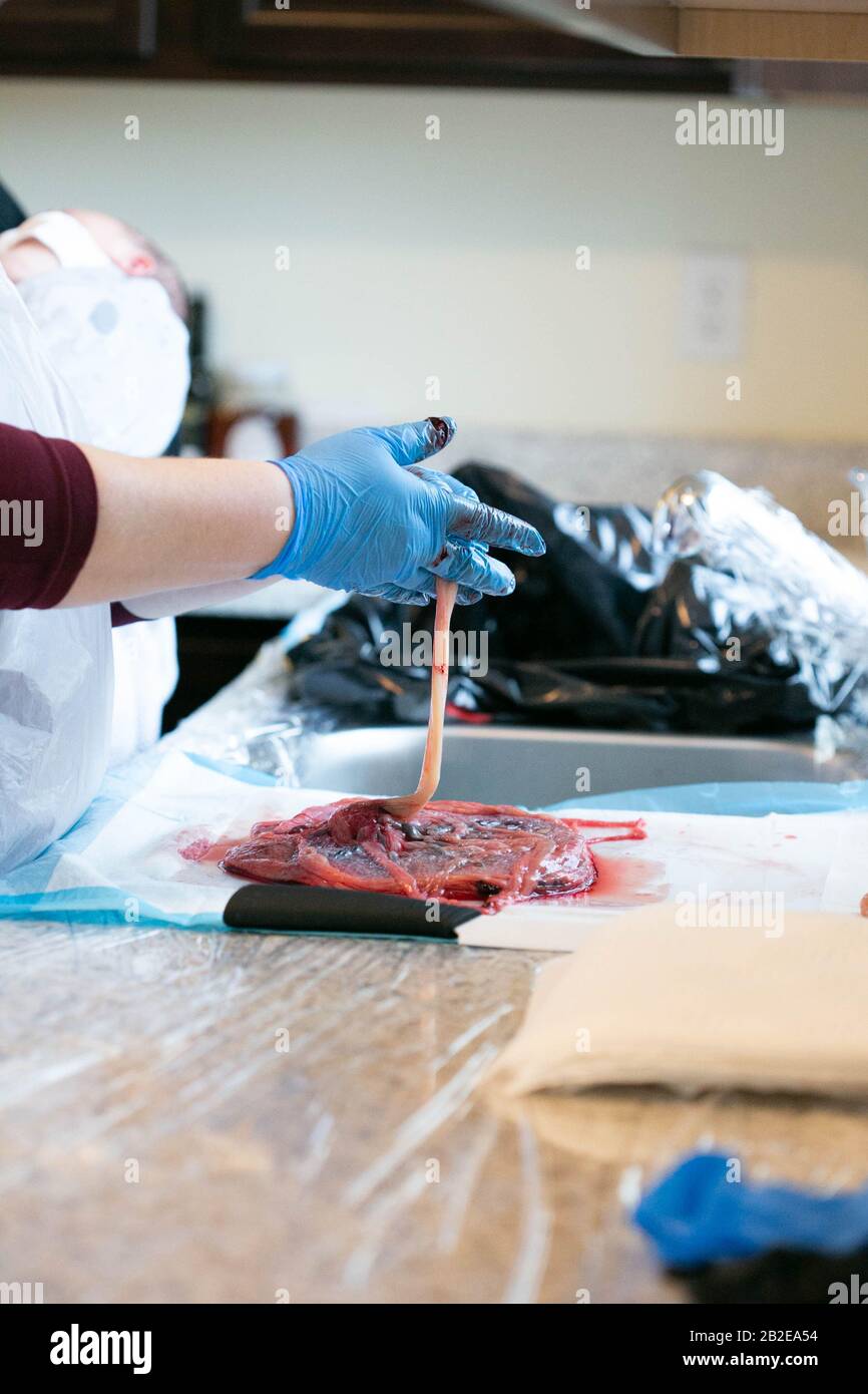 Handschuhhandchen, die Nabelschnur an der Plazenta halten. Stockfoto