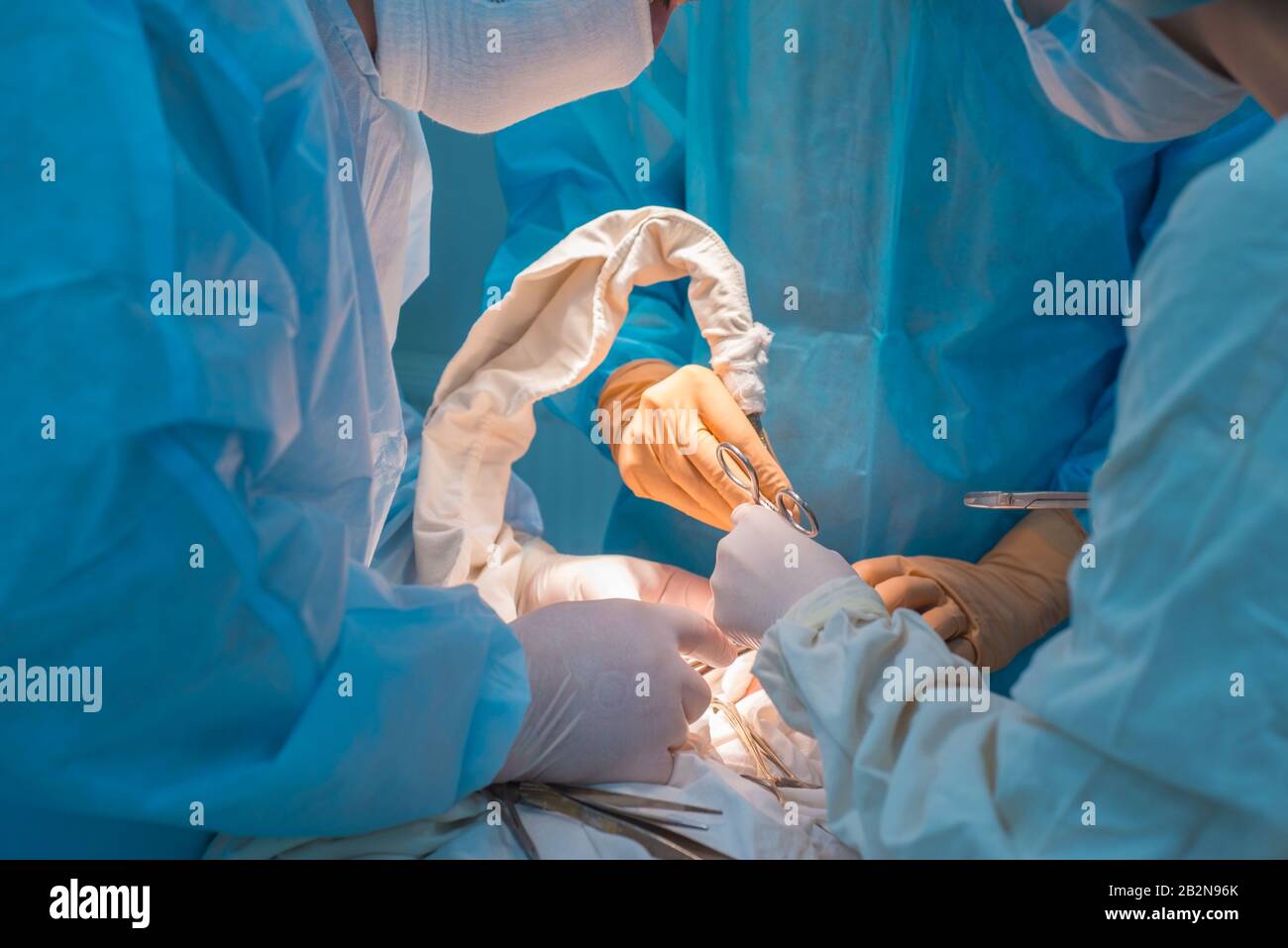Nahaufnahme, die Hände von Kinderchirurgen und ein Assistent, der einen kleinen Patienten mit einer Hinter-Ohr-Lymphadenitis operiert. In einem sterilen Operationssaal. R Stockfoto