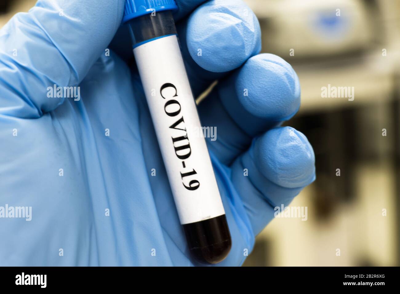 Bluttest für COVID-19. Untersuchung einer Blutprobe auf das Vorhandensein von SARS-COV-2-Coronavirus. Stockfoto
