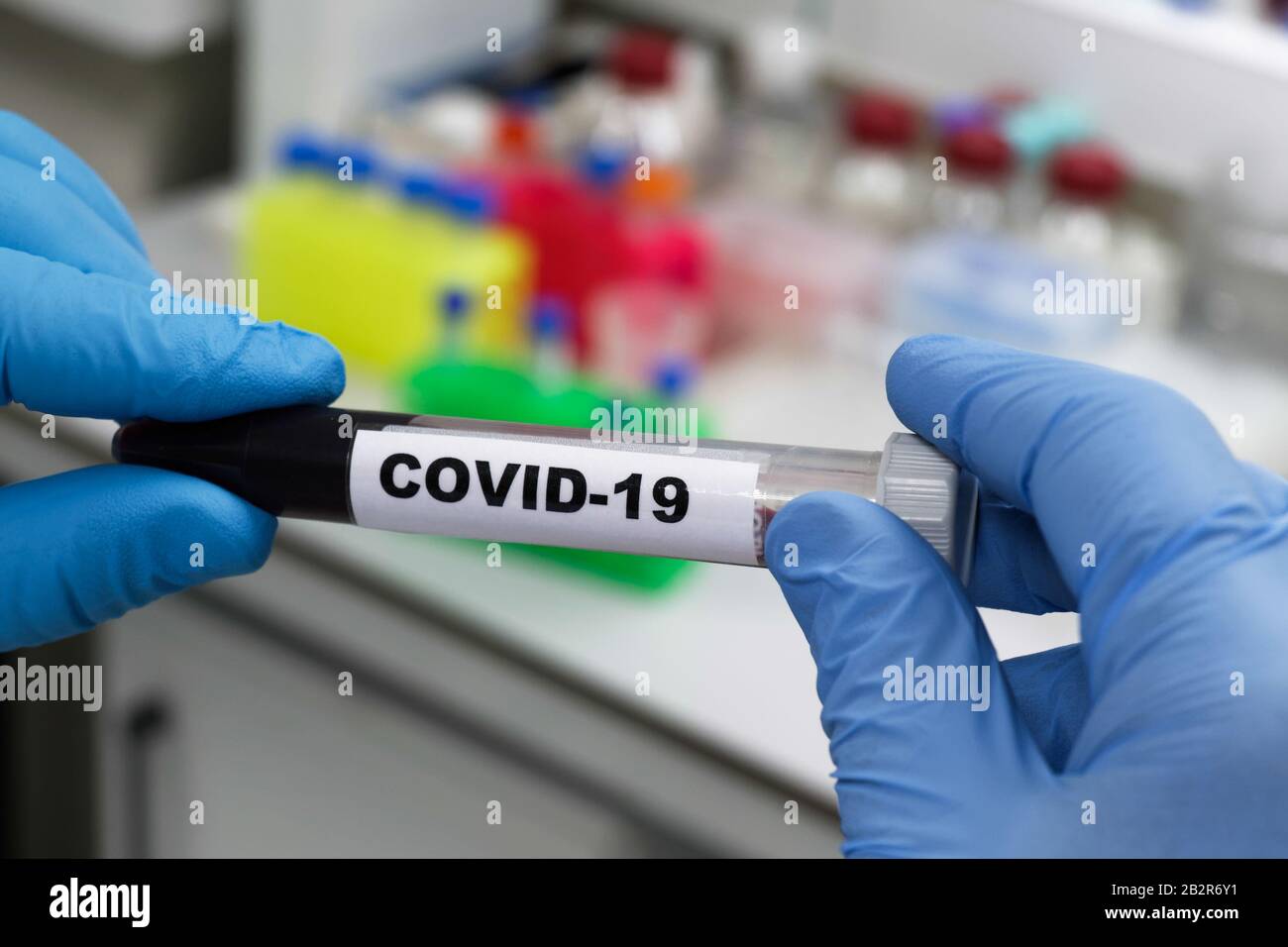 Bluttest für COVID-19. Untersuchung einer Blutprobe auf das Vorhandensein von SARS-COV-2-Coronavirus. Stockfoto