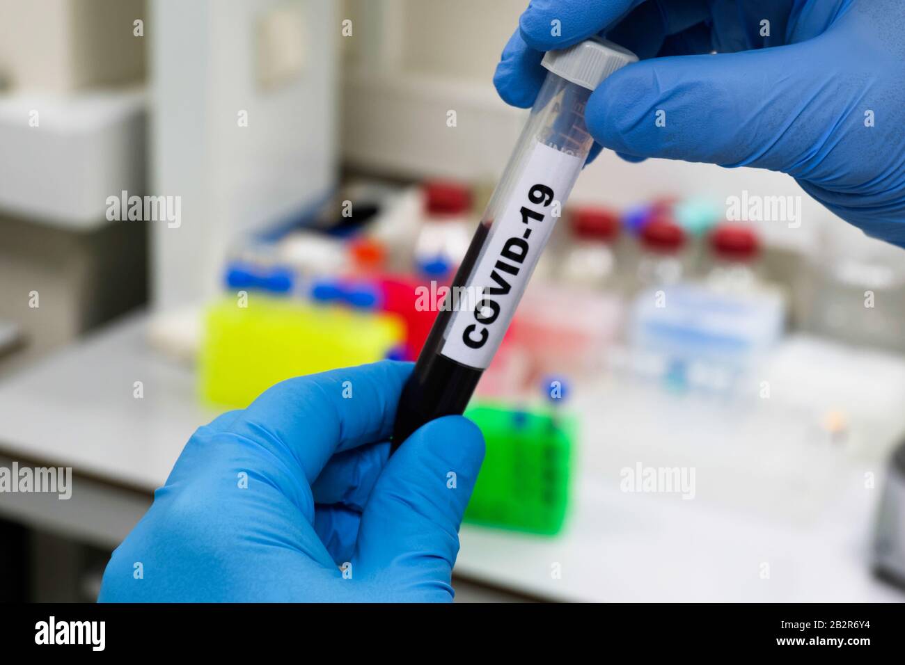 Bluttest für COVID-19. Untersuchung einer Blutprobe auf das Vorhandensein von SARS-COV-2-Coronavirus. Stockfoto