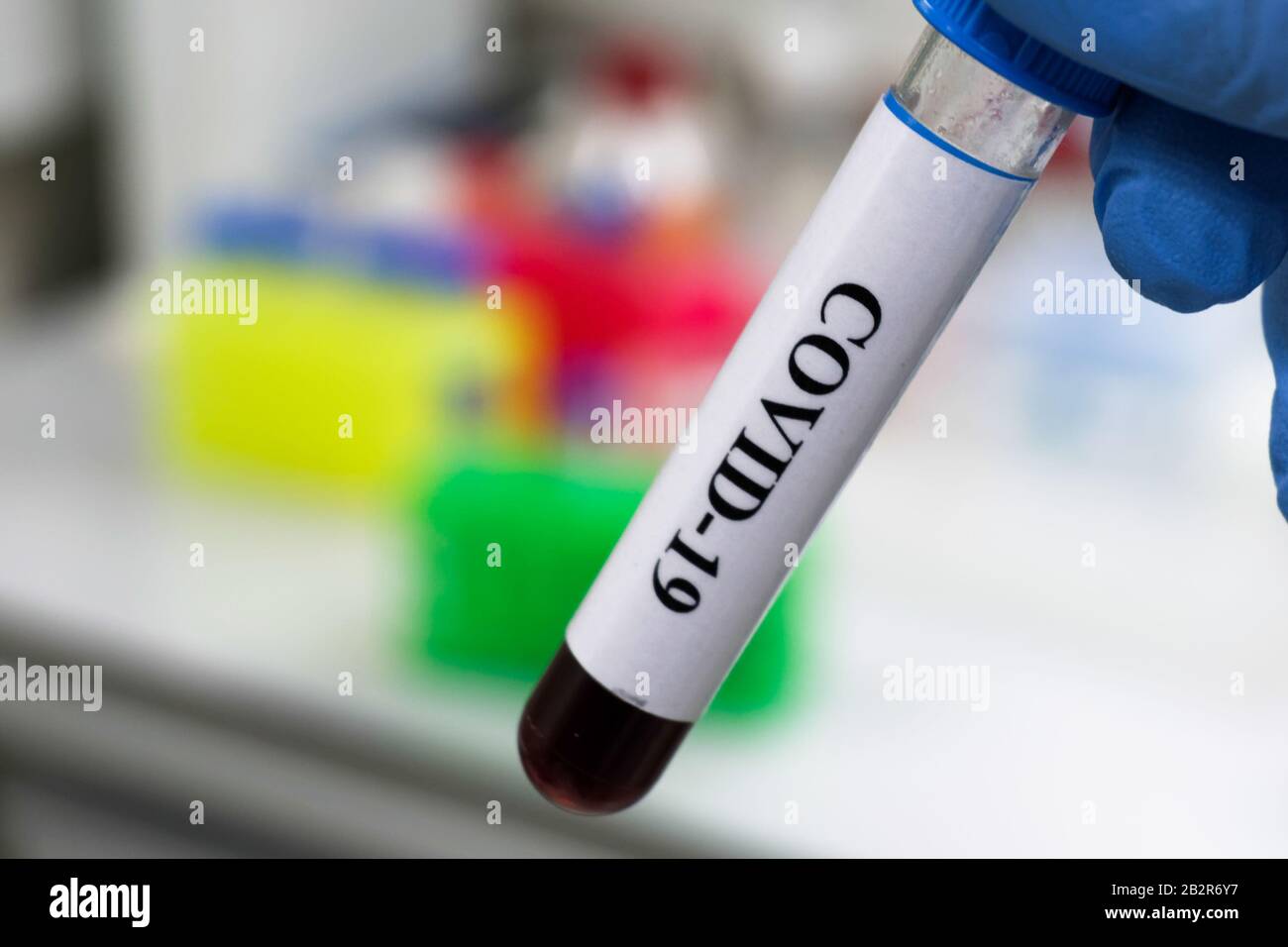 Bluttest für COVID-19. Untersuchung einer Blutprobe auf das Vorhandensein von SARS-COV-2-Coronavirus. Stockfoto