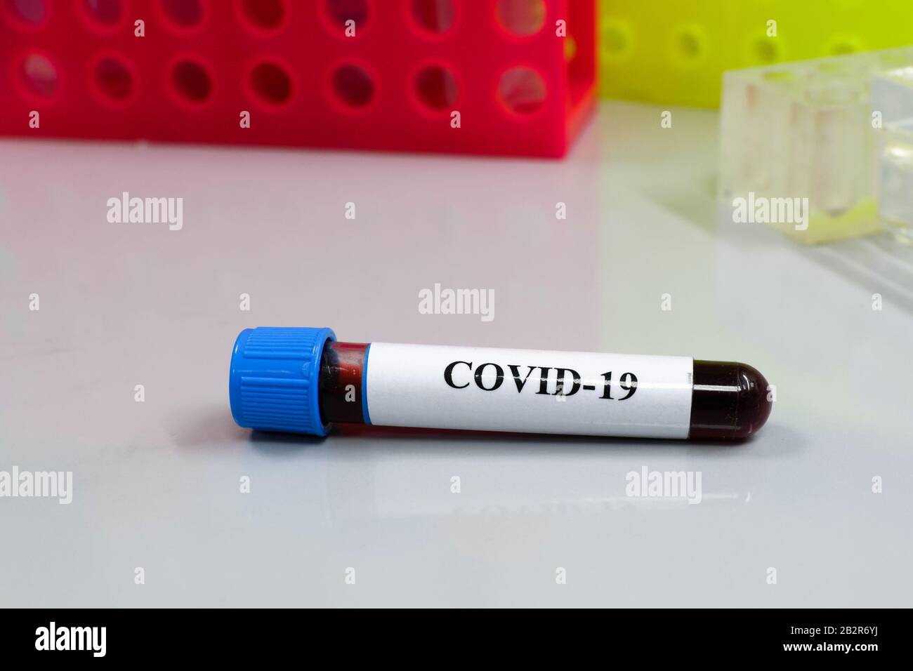 Bluttest für COVID-19. Untersuchung einer Blutprobe auf das Vorhandensein von SARS-COV-2-Coronavirus. Stockfoto