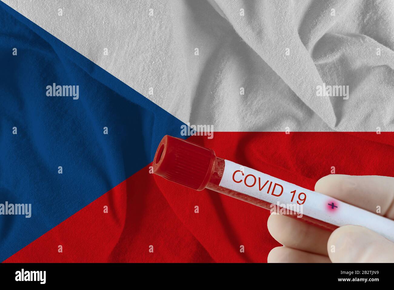 Blutprobe mit COVID-19 Coronavirus chinesische Infektion der Tschechischen Republik mit Test im medizinischen Untersuchungslabor Stockfoto