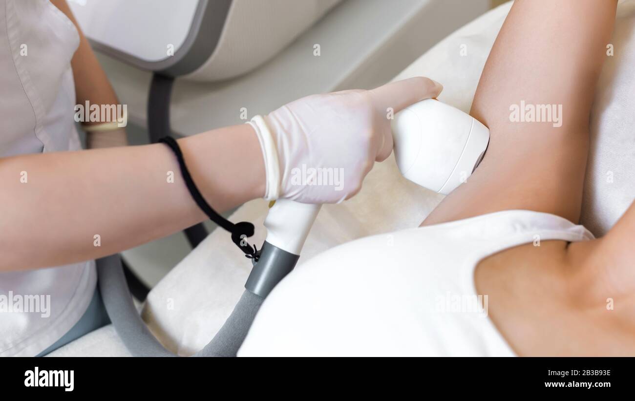 Laserhaarentfernung unter den Achseln. Stockfoto