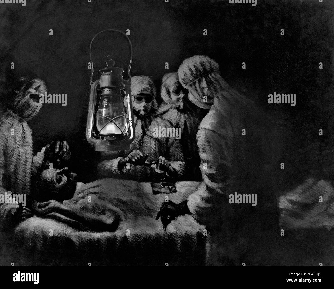 Mahatma Gandhi Appendicitis Operation Malerei, wo plötzlich die Elektrizität ging und Betrieb fortgesetzt, indem Kerosin Lampe, Indien, Januar 1924, alten Jahrgang 1900s Bild Stockfoto