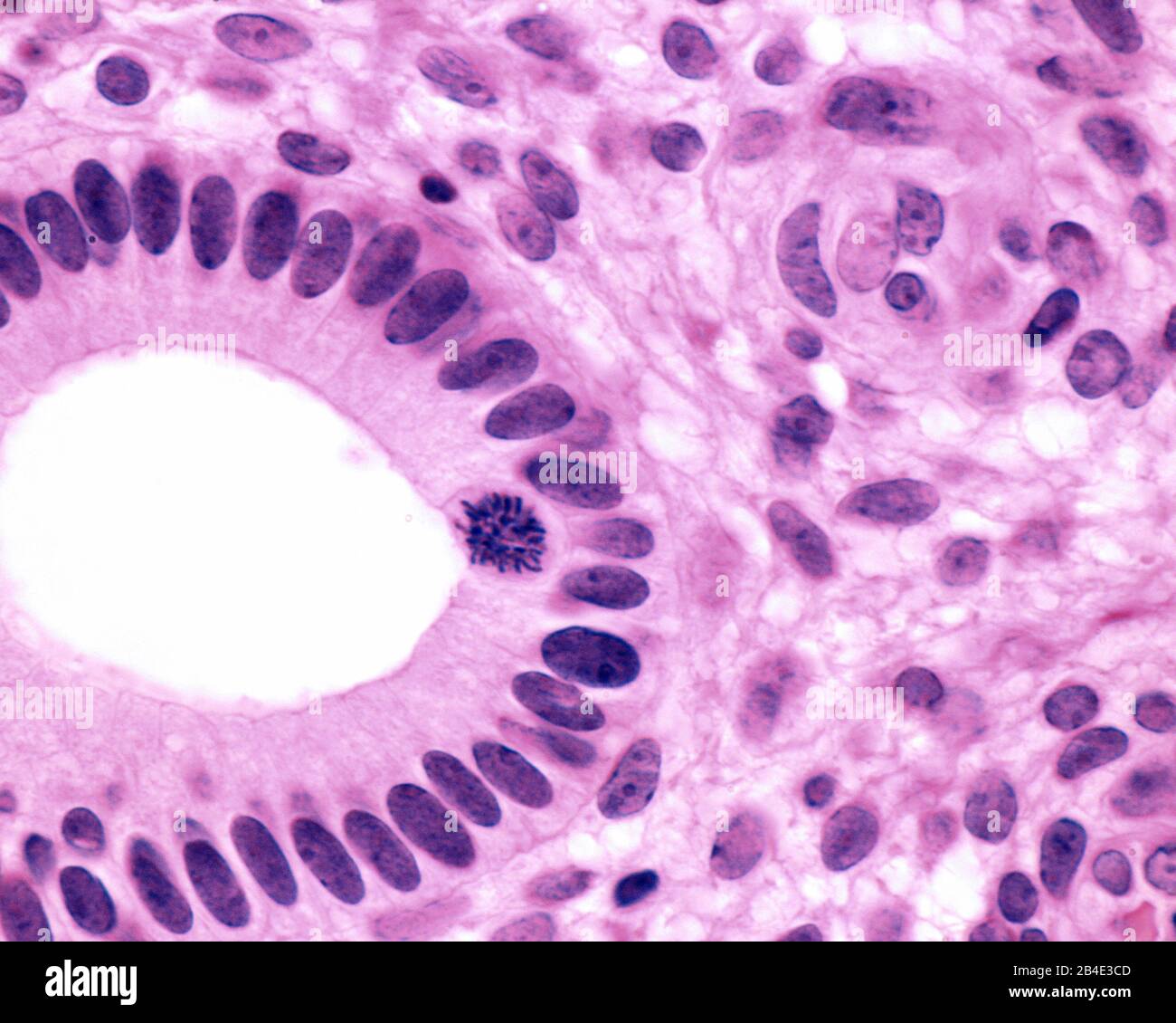 Querschnitt einer menschlichen Uterusdrüse. Das Epithel ist säuleneinfach und zeigt eine mitotische Zelle in der Nähe des Lumen. Stockfoto