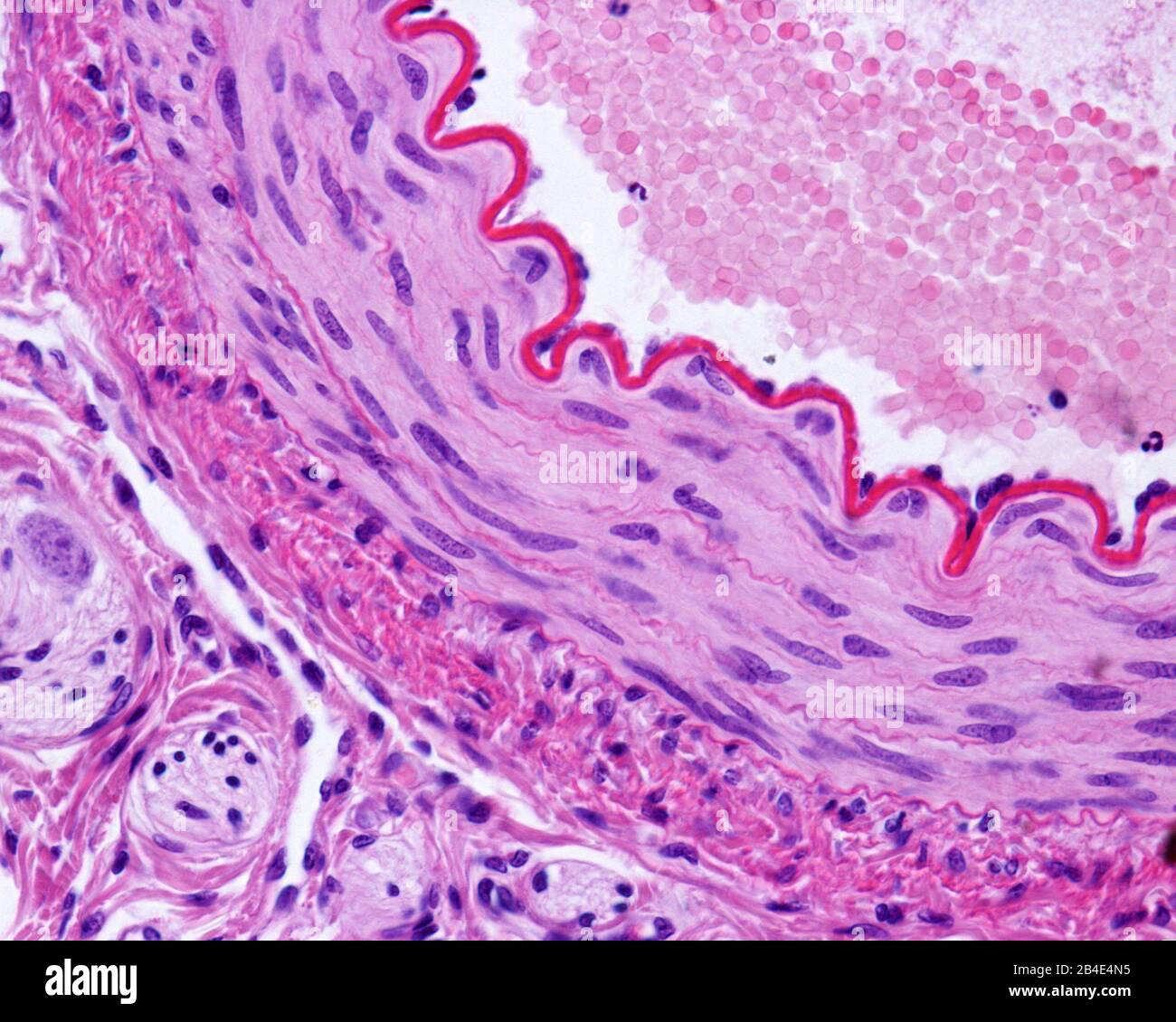 Helle Mikrografik einer muskulären Arterie mit Querschnitten, die eine dicke und wellige innere elastische Lamina zeigt, eine mittlere Schicht mit glatten Muskelfasern und Stockfoto