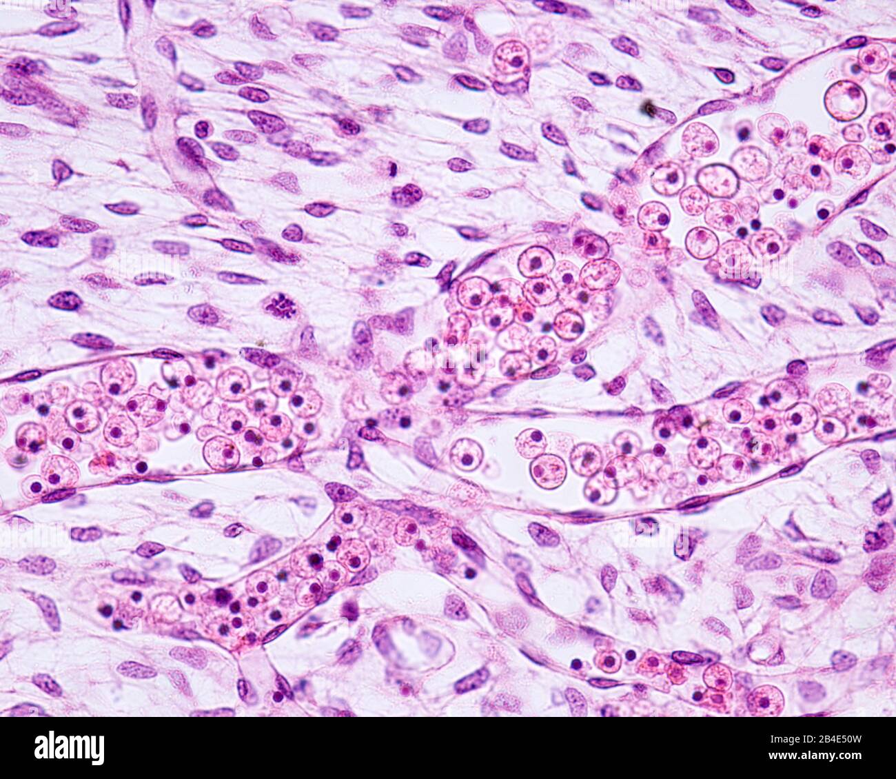 Blutgefäße in emonalem Gewebe. Die Gefäße sind von Endothel (einfachem Plattenepithel) gesäumt und enthalten im Inneren unreife, nukleierte Rotblut c Stockfoto