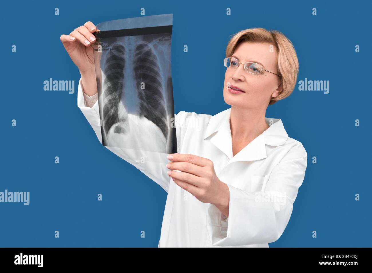 Selbstbewusster Arzt im mittleren Alter, isoliert auf blauem Hintergrund stehend, Röntgenbild in den Händen halten, Lungen überprüfen und ruhig lächeln Stockfoto
