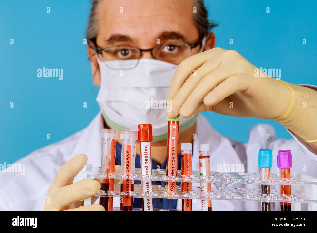 Arzt in Gesichtsmaske Vakuumröhrchen für Blutproben mit COVID-19 Coronavirus chinesische Infektion atypische Pneumonie Virus Stockfoto