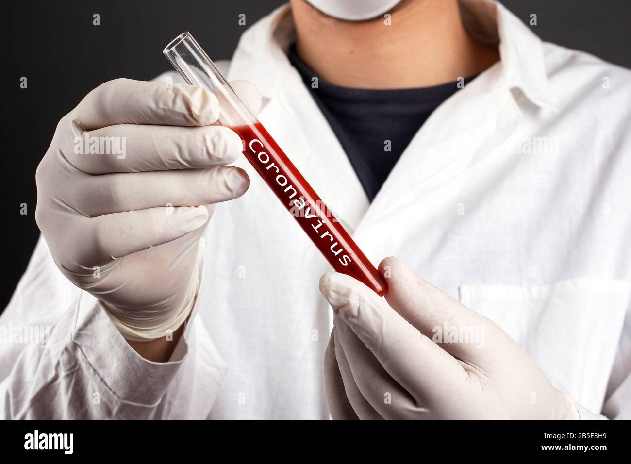 Doktor hält ein Reagenzglas mit infektiöser viraler Erkrankung der Atemwege, Kovid - 19 Nahaufnahme. Behandlungimpfstoff. Stockfoto