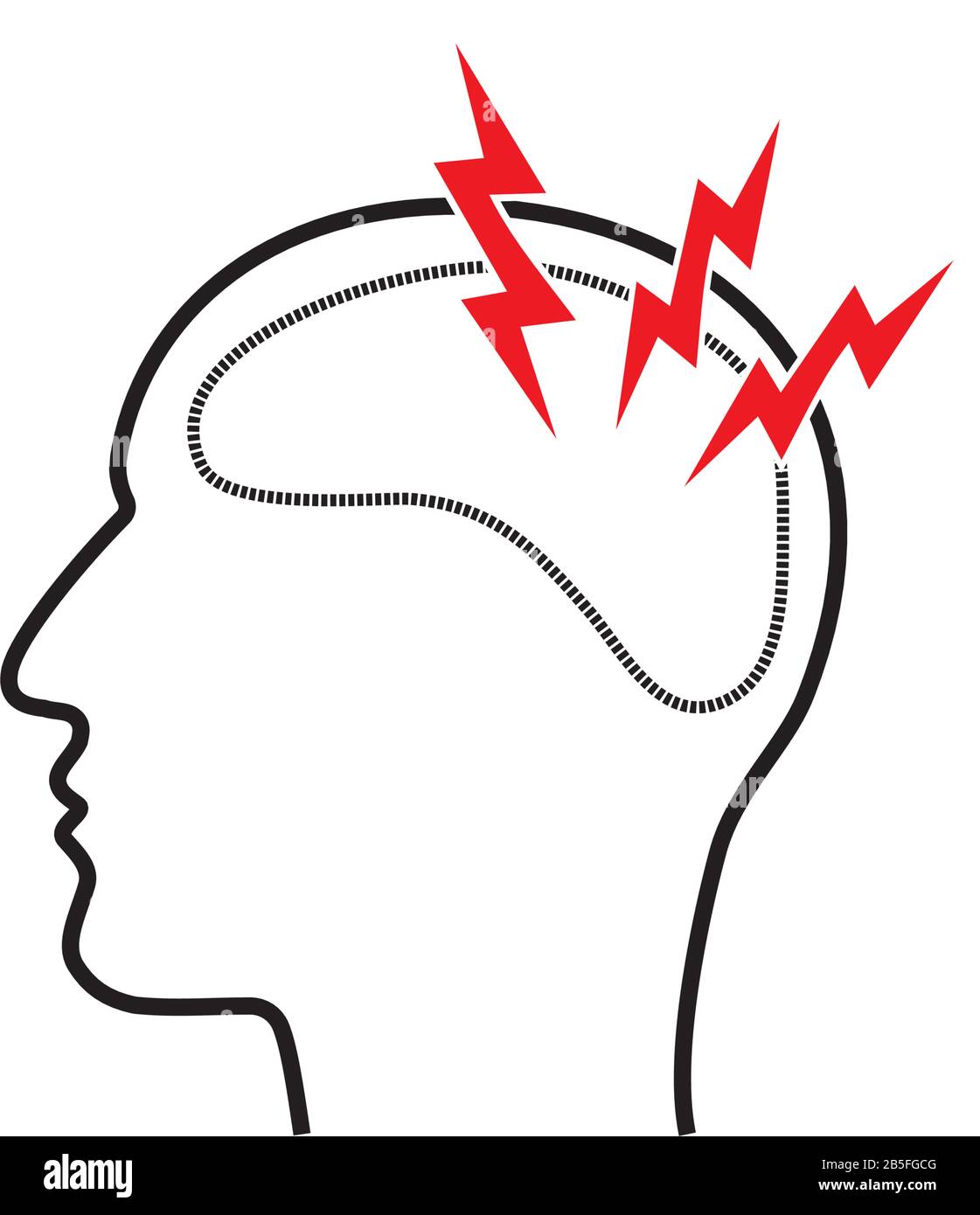 Migräne-Kopfschmerzen-Schmerzen und Bildkonzept für Erkrankungen des zentralen Nervensystems. Profilumriss des menschlichen Kopfes mit drei roten Blitzen im weißen Hintergrund. Ve Stock Vektor