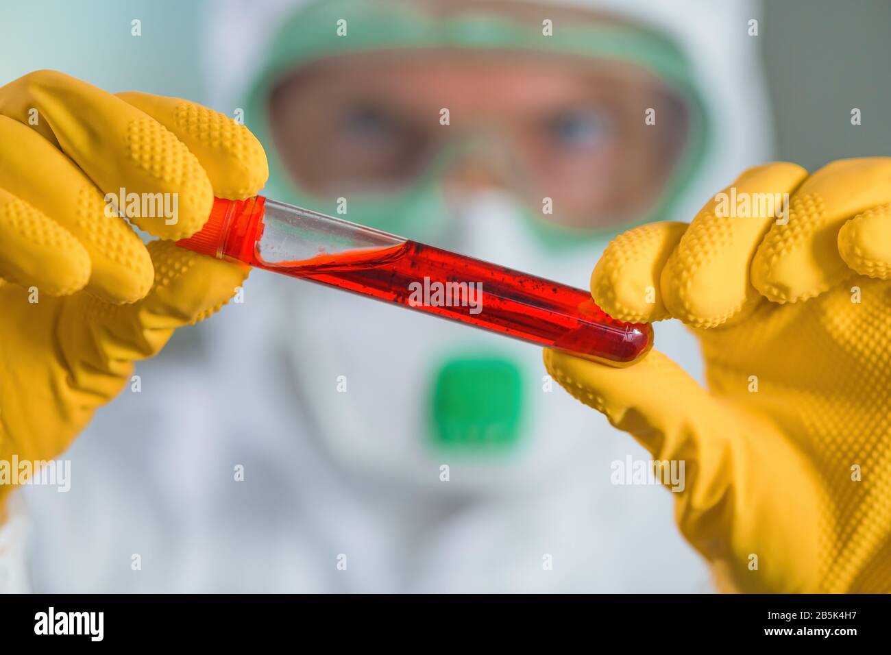 Der Epidemiologe untersucht das medizinische Proben-Reagenzglas unter Virusquarantäne und testet das Blut des Patienten bei einem Virusinfektionsausbruch Stockfoto