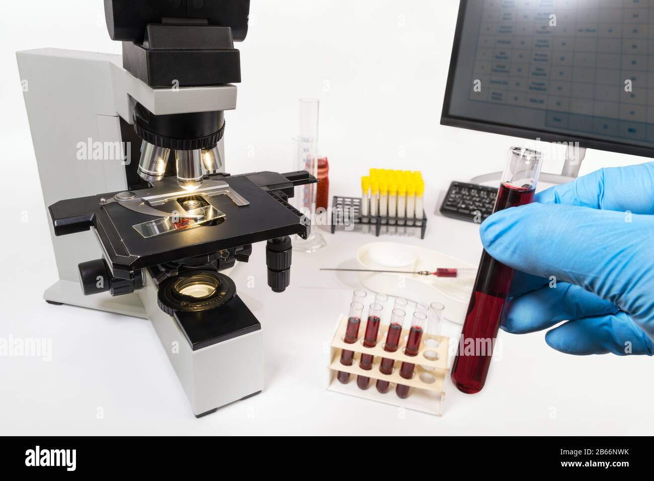 Labordiagnostik. Optisches Mikroskop und Hand in blauem Handschuhhalter für Röhrchenprobe. Computermonitor und Reagenzgläser in Racks im Krankenhaus. Stockfoto