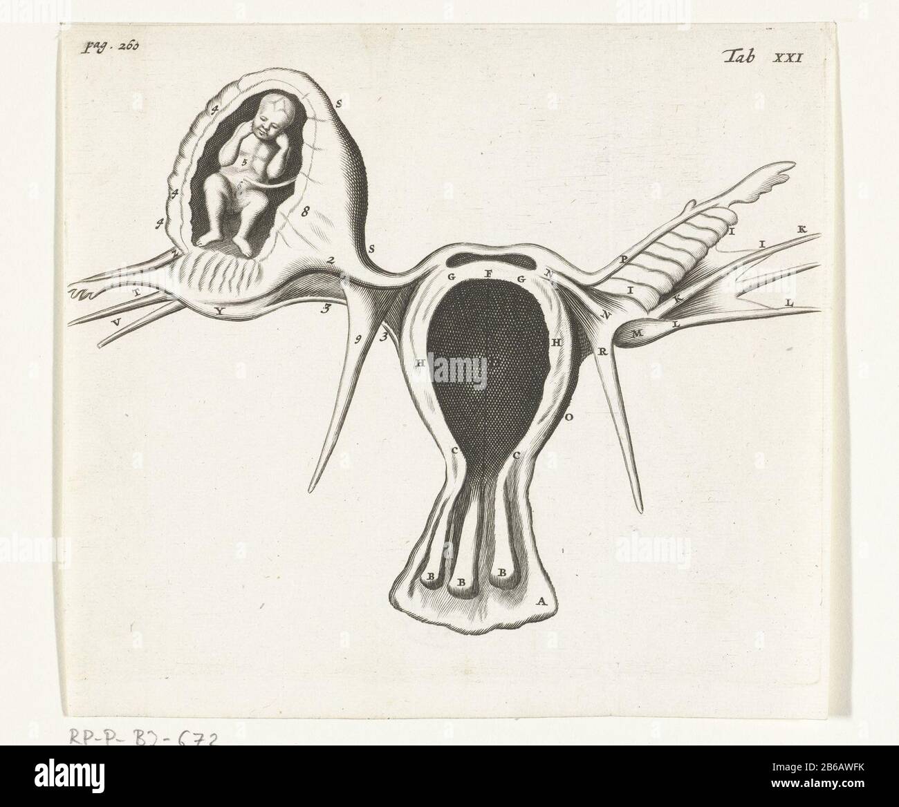 Anatomische Darstellung eines ektopischen Schwangerschaftsbuches Reinier de Graaf, das mulierum Organismen generationi inservientibus tractatus novus, 1672 Journal eines Buches über die Funktionsweise der weiblichen Genitalien. Tabula XXI. Hersteller : Druckmaschine: Hendrik Barynaar Zeichnung: Reinier de Graaf Verlag: Dispensing HackianaPlaats Herstellung: Druckmaschine: Der niederländische Verleger: Leiden Datum: 1672 Physikalische Eigenschaften: Engra-Material: Papiertechnik: Engra-Messungen (Druckverfahren): Plattenkante: H 145 mm × W 166 mmToelichtingIllustratie für: Reinier de Graaf, Mulierum oder das Stockfoto