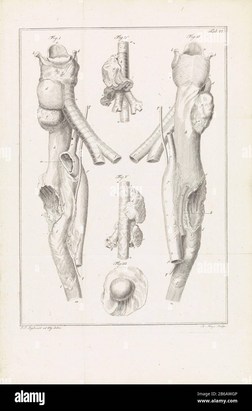 Anatomische Abbildung anatomische Abbildung. Rechts: Tab. VI Hersteller: Druckmaschine: Robbert Muys (auf dem Objekt angegeben) zur Zeichnung von: Joannis Jacobus Ax Standaert (auf dem Objekt angegeben) Datum: 1752 - 1832 Physikalische Eigenschaften: Ätzungs- und Engra-Material: Papiertechnik: Ätzung/Engra-Messungen (Druckverfahren) Maße: Plattenkante: H 336 mm × W 240 mm Betreff: Physiologie und Anatomie (+ wissenschaftliche Forschung) Stockfoto