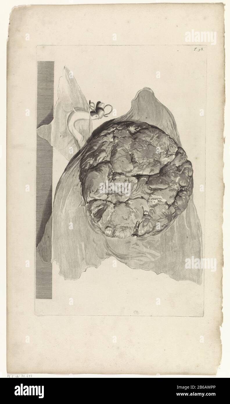 Anatomische Untersuchung der Oberseite der Plazenta anatomische Studie der Oberseite der Plazenta . Oben rechts nummeriert T. 58. Hersteller : Druckmaschine: Pieter of Grace In Zeichnung: Gerard de Lairesse Herausgeber: Witwe Joannes van Someren Verlag: Hendrick und Dirk Tree City Herstellung: Amsterdam Datum: 1685 Physikalische Eigenschaften: Engra und Punktgra-Material: Papiertechnik: Engraa (Druckverfahren) Messungen: Plattenkante b 275 mm x h 439 mmToelichtingBoekillustriatie für Bidloo, Godefridus. Anatomia humani corporis centum & Chinque tabulis per Art. G. de Lairesse ad vivum delineatis the m Stockfoto