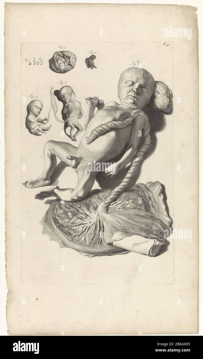 Anatomische Studie eines Fötus anatomische Studie eines Fötus. Oben rechts mit der Nummer T. 57. Hersteller : Druckmaschine: Pieter of Grace In Zeichnung: Gerard de Lairesse Herausgeber: Witwe Joannes van Someren Verlag: Hendrick und Dirk Tree City Herstellung: Amsterdam Datum: 1685 Physikalische Eigenschaften: Engra und Punktgra-Material: Papiertechnik: Engraa (Druckverfahren) Messungen: Plattenkante b 278 mm × h 438 mmToelichtingBoekillustriatie für Bidloo, Godefridus. Anatomia humani corporis centum & Chinque tabulis per Art. G. de Lairesse ad vivum delineatis the monstrata, veterum recentiorumque Stockfoto