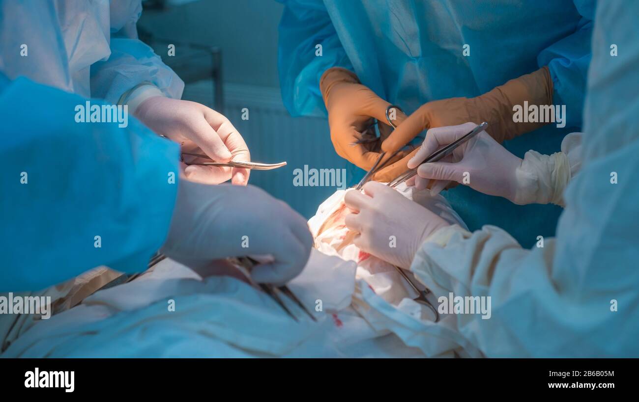 Nahaufnahme, die Hände von Kinderchirurgen und ein Assistent, der einen kleinen Patienten mit einer Hinter-Ohr-Lymphadenitis operiert. In einem sterilen Operationssaal. R Stockfoto