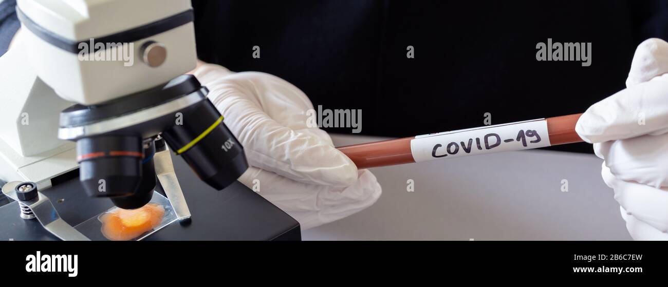 Banner, Röhrchen zur Analyse und Probenahme von Covid-19-infektiösem Disea Stockfoto