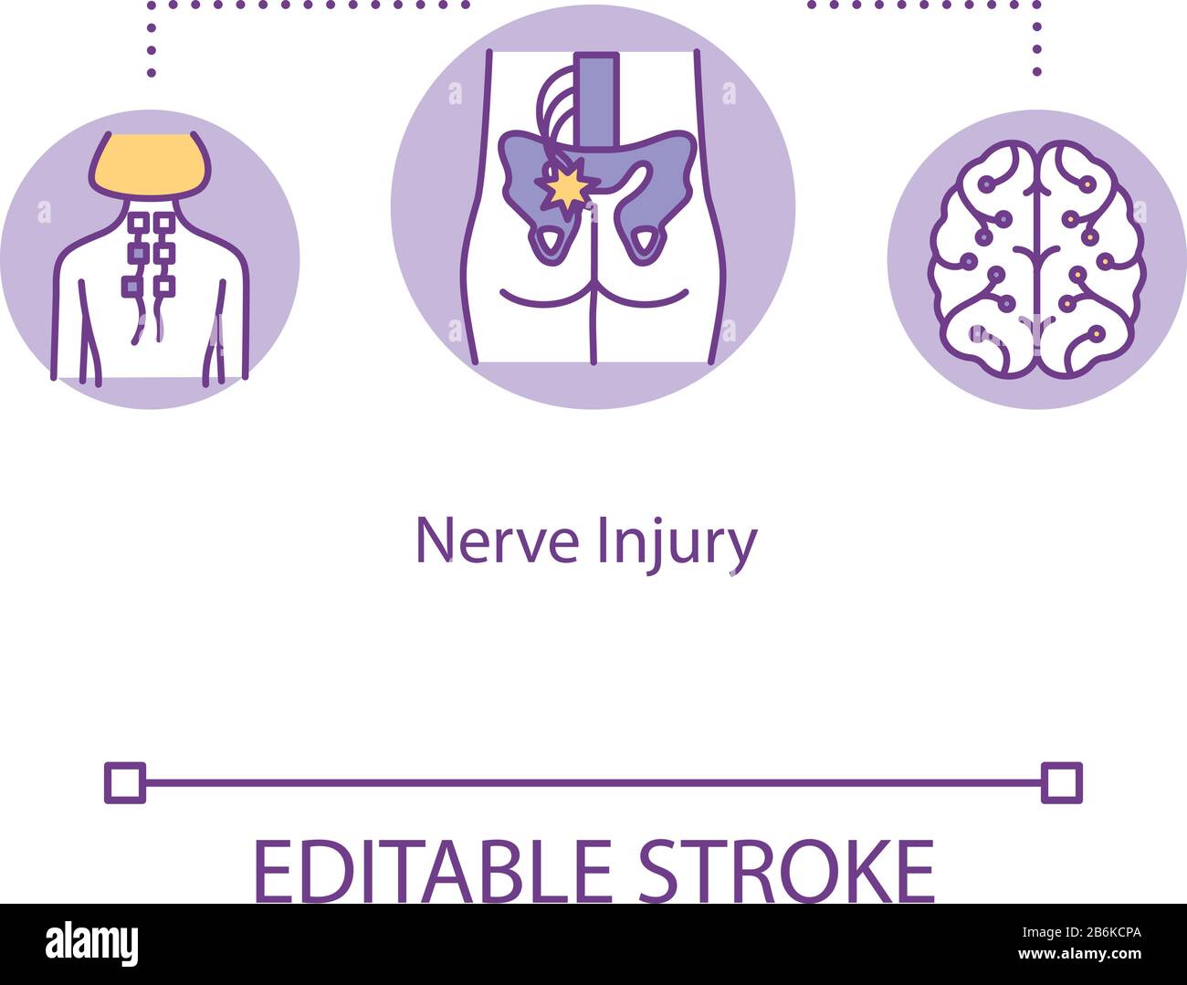 Symbol für Nervenverletzung, Trauma des Nervengewebes. Neurapraxie