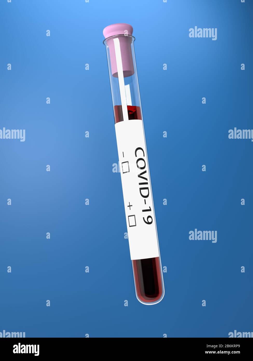 3D-Rendering von medizinischem Reagenzglas mit Covid-19-Blutprobe auf blauem Hintergrund Stockfoto