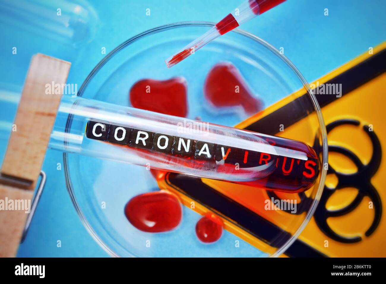 Biohazarazard-Zeichen, Petrischale und Reagenzglas, Coronavirus-Ausbruch Stockfoto