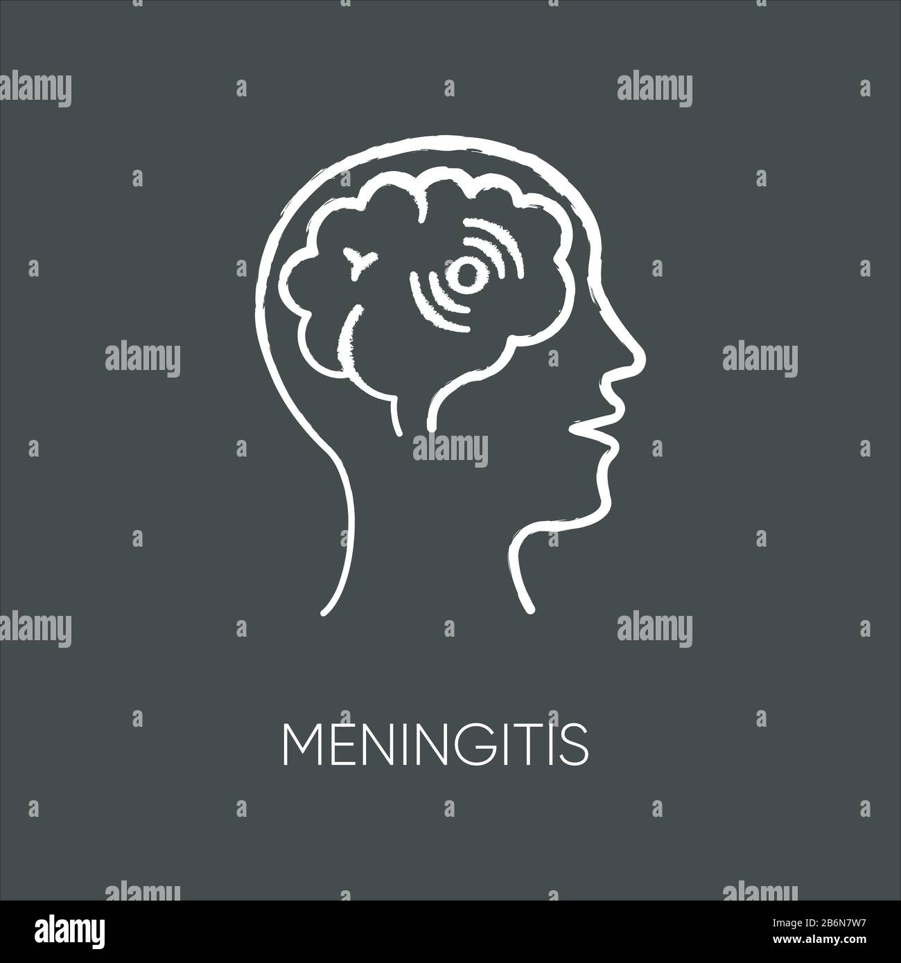 Meningitis Kreide weiße Ikone auf schwarzem Hintergrund. Ansteckende Meningokokkenerkrankung, gefährliche Meningenentzündung. Bakterielle Hirninfektion isoliert Stock Vektor