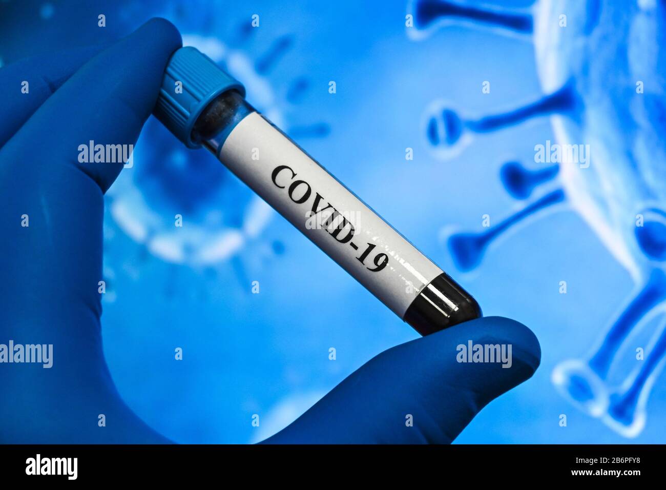 Blutuntersuchungen für das Coronavirus, das COVID-19 verursacht. Eine Blutprobe für die Prüfung auf SARS-COV-2. Stockfoto