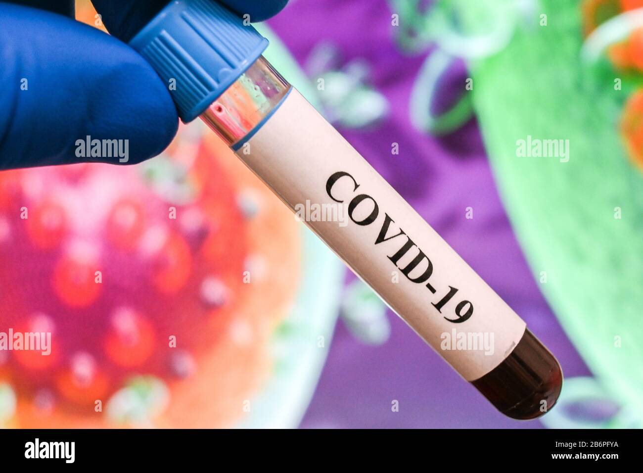 Blutuntersuchungen für das Coronavirus, das COVID-19 verursacht. Eine Blutprobe für die Prüfung auf SARS-COV-2. Stockfoto