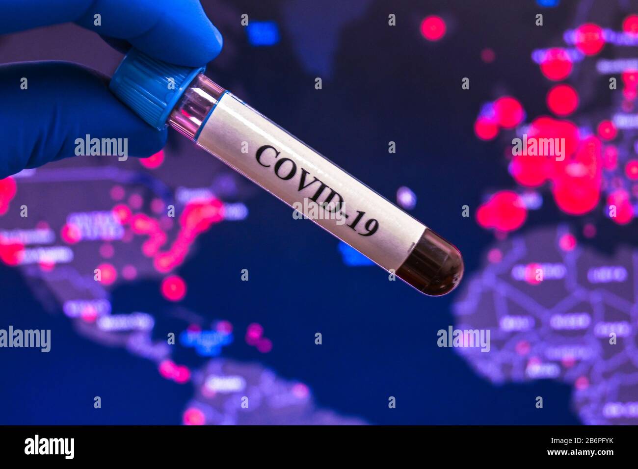 Blutuntersuchungen für das Coronavirus, das COVID-19 verursacht. Eine Blutprobe für die Prüfung auf SARS-COV-2. Stockfoto
