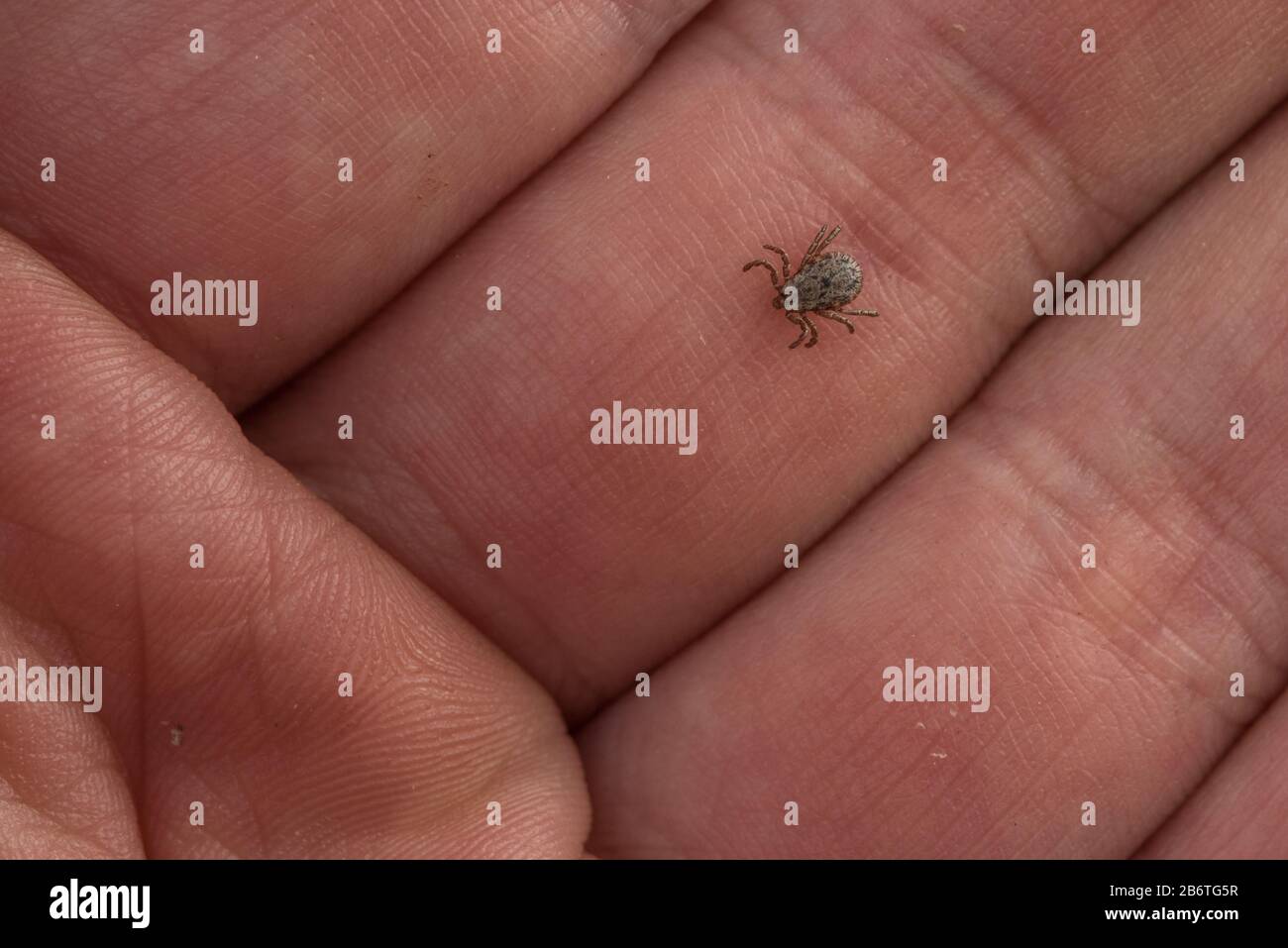 Eine winzige Zecke (Dermacentor occidentalis), ein Krankheitsvektor krabbelt in Berkeley, Kalifornien, auf der Hand der Fotografen. Stockfoto