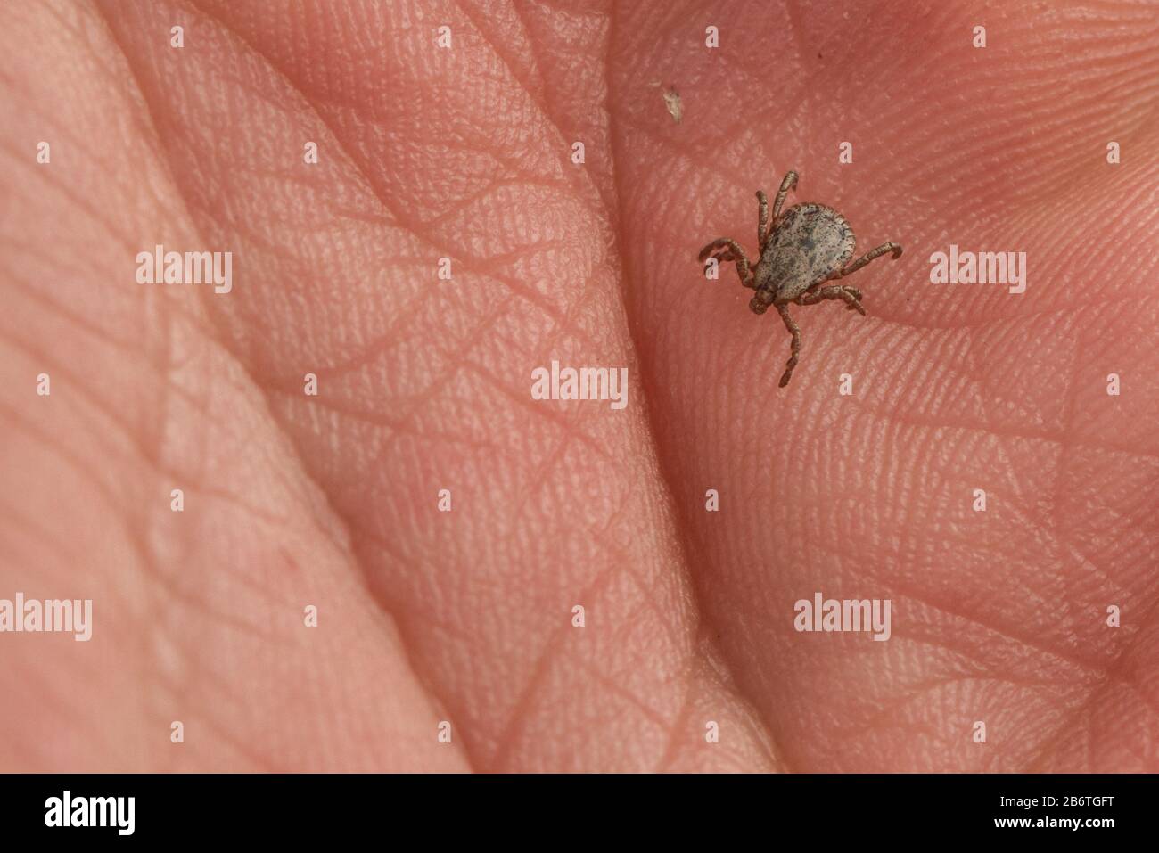 Eine winzige Zecke (Dermacentor occidentalis), ein Krankheitsvektor krabbelt in Berkeley, Kalifornien, auf der Hand der Fotografen. Stockfoto