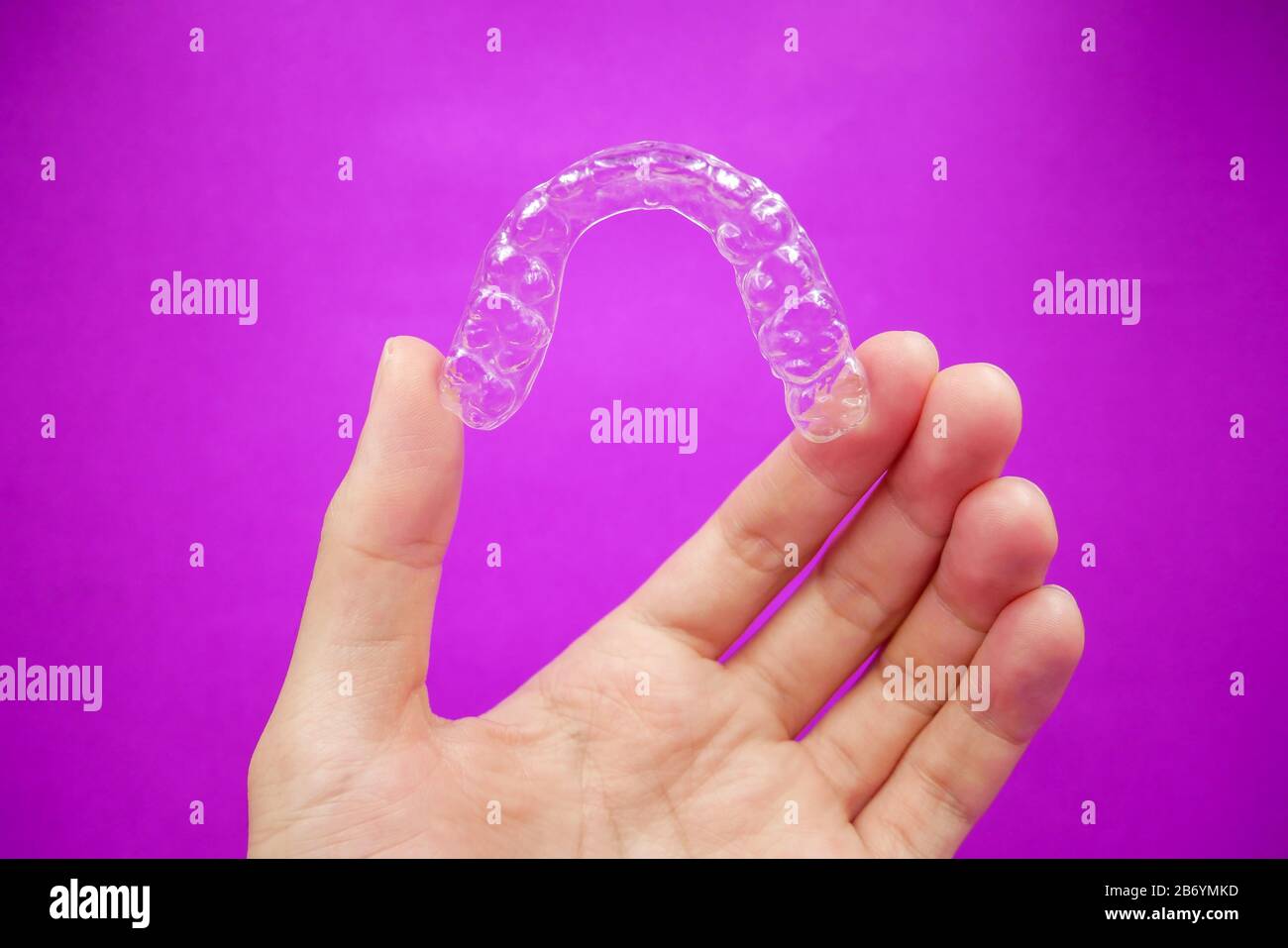 Die Hand hält klare Kunststoffhalterzähne, die auf violettem Hintergrund isoliert sind. Es ist eine Ausrüstung für Kieferorthopäden, die den Patienten kieferorthopädischen Surg geben Stockfoto
