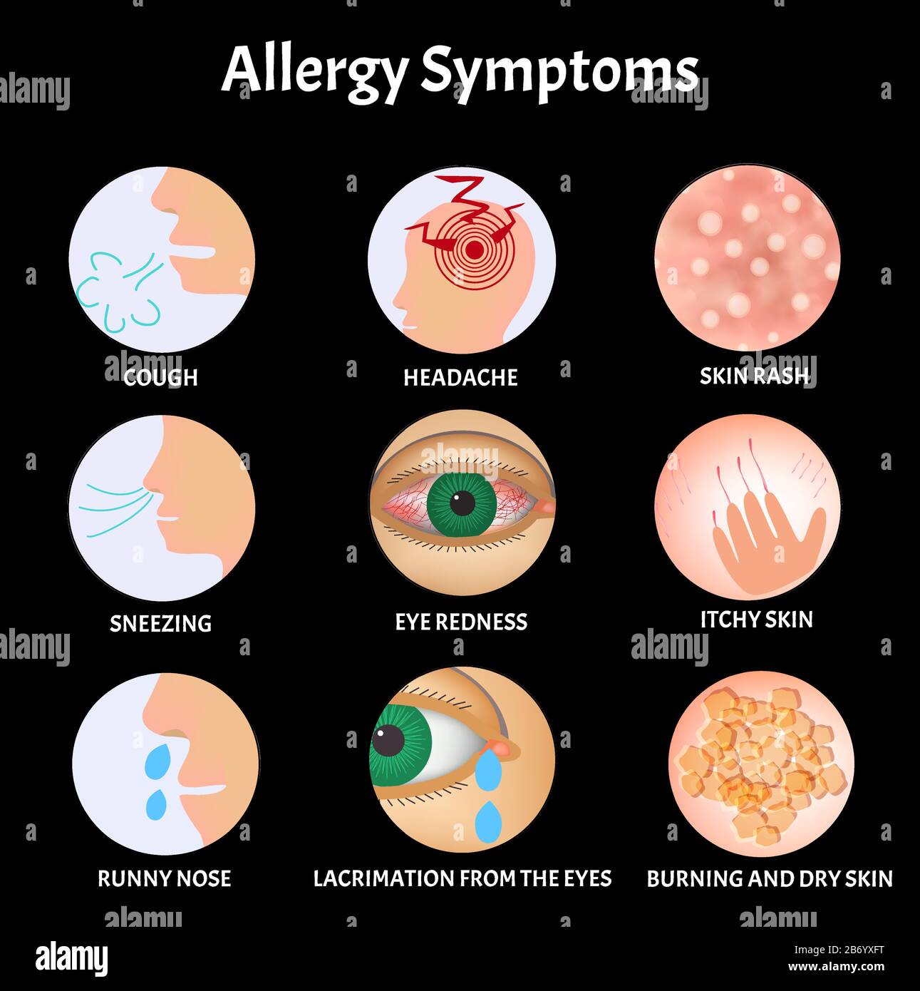 Symptome von Allergien Hautausschlag, Allergischer Hautjuckung, Tränen aus  den Augen, Husten, Niesen, Laufende Nase, Kopfschmerzen, Rötungen der Augen  Stock-Vektorgrafik - Alamy
