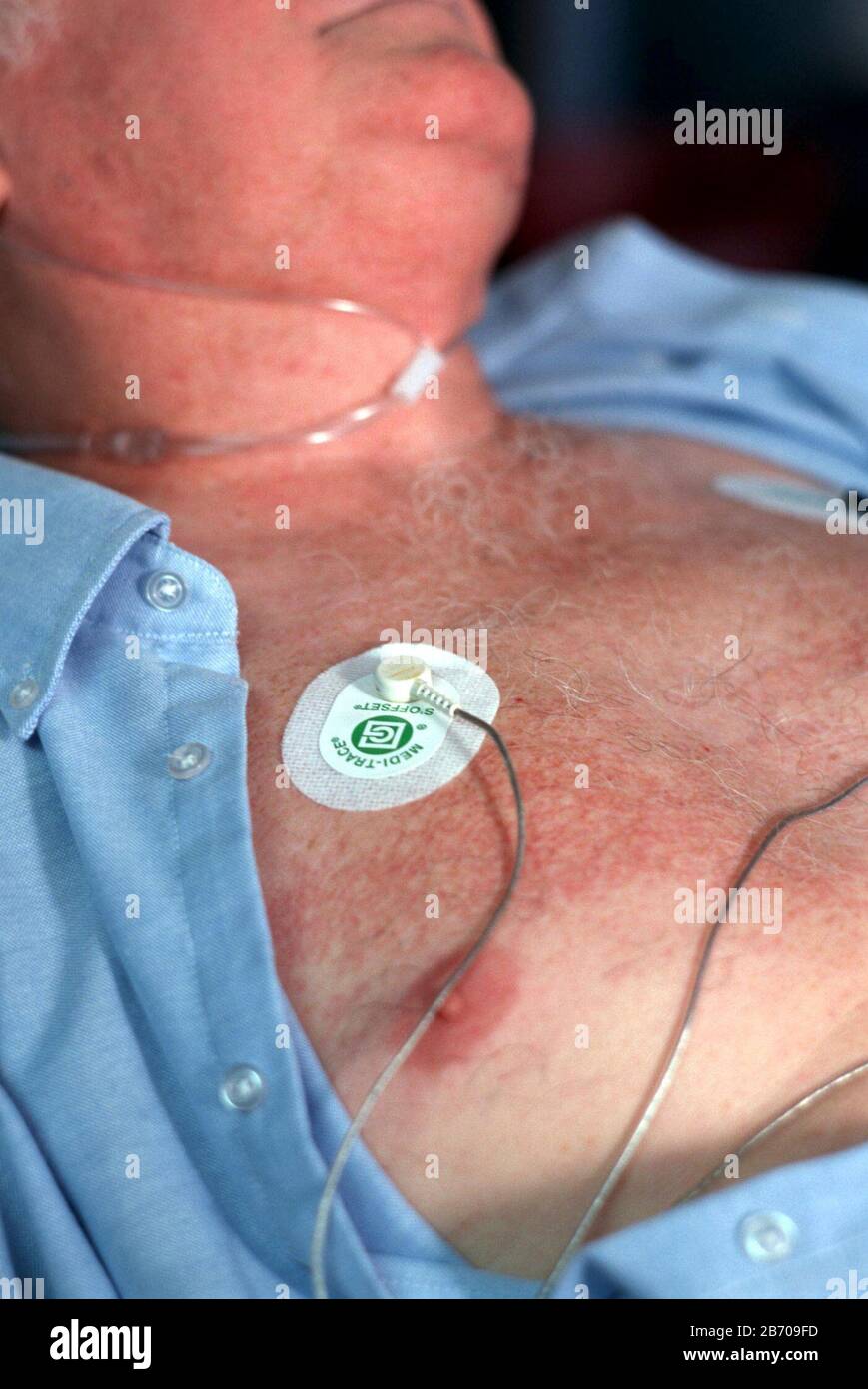 McGehee, Arkansas USA 1996: Illustration eines Herzinfarktopfern, das in einem ländlichen Krankenhaus in Arkansas in die Notaufnahme eintrat. Modell Freigegeben. ©Bob Daemmrich Stockfoto