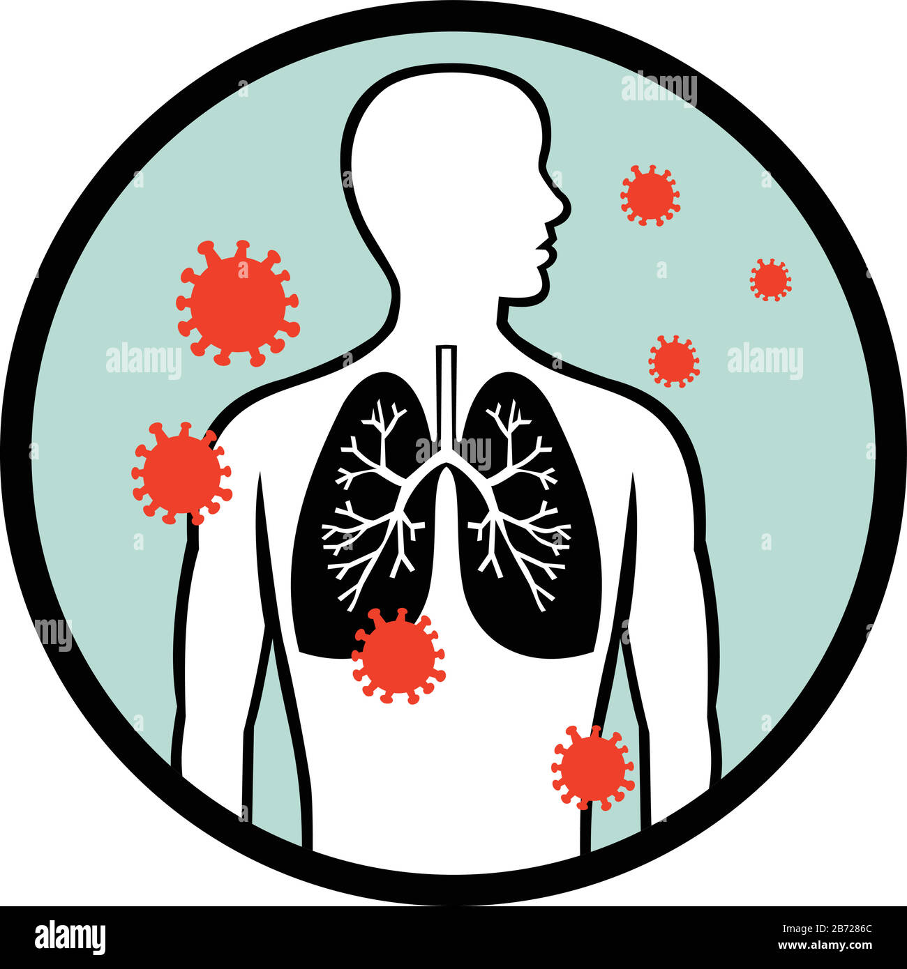 Retro-Darstellung der Coronavirus-Zelle, die die menschliche Lunge oder das Atmungssystem infiziert, die innerhalb der Kreisform auf isoliertem weißem Hintergrund festgelegt ist. Stock Vektor
