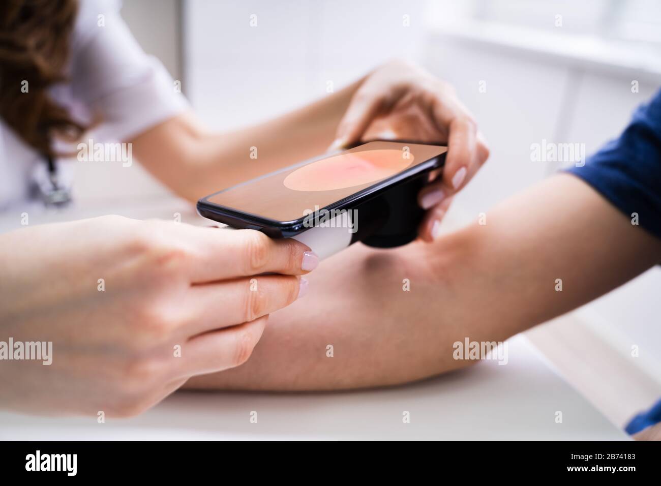Weibliche Ärztin Untersucht Pigmentierte Haut Von Männlichen Patienten Stockfoto