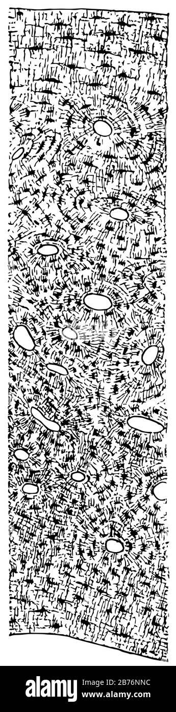 Diese Abbildung zeigt den Querschnitt eines langen Knochens, einer Vintage-Zeichnung oder einer Gravurzeichnung. Stock Vektor