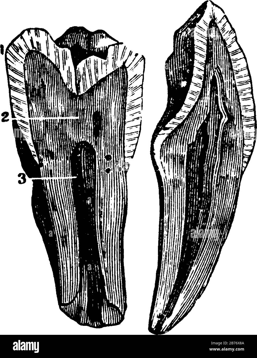 Die Innenansicht eines Zahns, der von oben oder von der Krone bis zu den Spitzen der Wurzel durchschnitten wird, mit den beschrifteten Teilen, 1, Email; 2, Dentin; 3, Fruchtfleisch, Vinta Stock Vektor