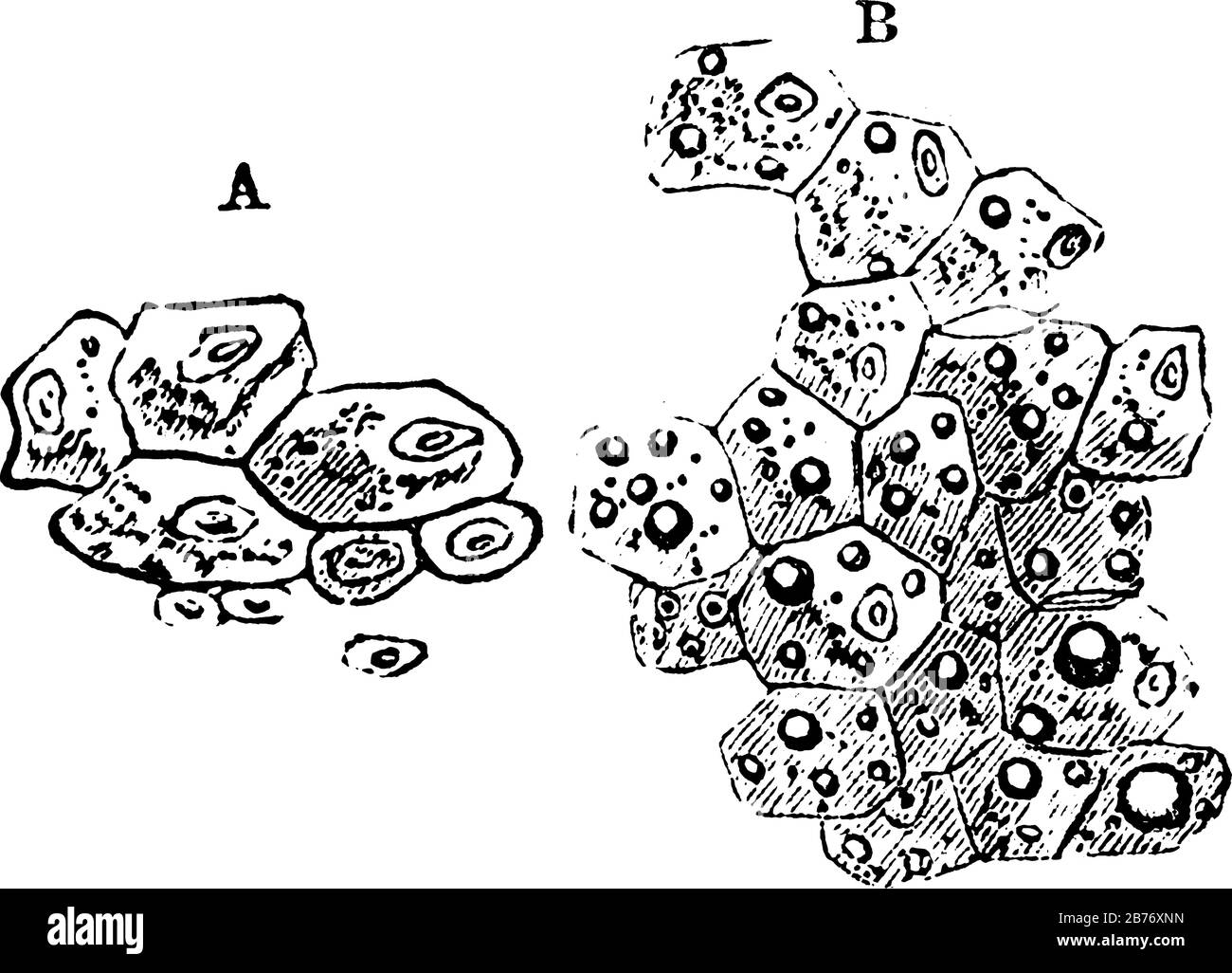 Eine typische Darstellung von Leberzellen, gekennzeichnet, A, Leberzellen und B, Leberzellen, die verschiedene große Fettpartikel enthalten, Vintage-Linien-Zeichnung Stock Vektor Eine typische Darstellung von Leberzellen, gekennzeichnet, A, Leberzellen und B, Leberzellen, die verschiedene große Fettpartikel enthalten, Vintage-Linien-Zeichnung Stock Vektor