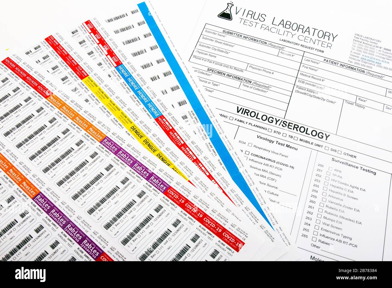Mehrere Etiketten verschiedener Viren- und Labortestberichte für Coronavirus, Tollwut, Hepatitis und andere. Stockfoto